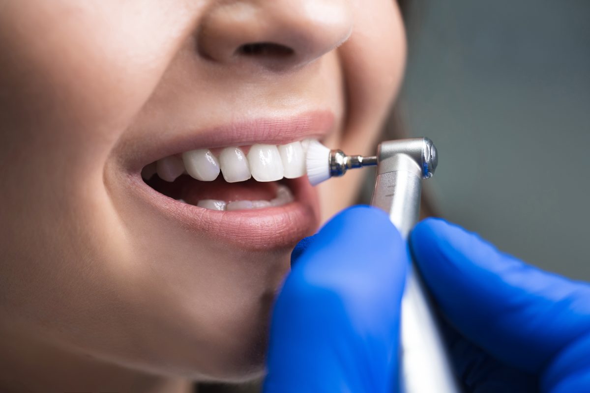 How Much Does Teeth Cleaning Cost And What Does It Include? Market Fobs